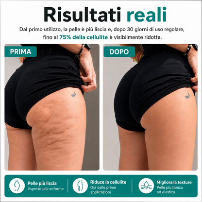 Massaggiatore Elettrico Anti Cellulite